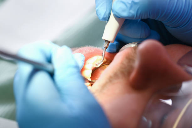 Best Root Canal Emergency Dentist  in Grayslake, IL